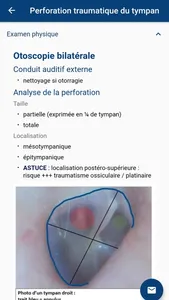 Urgences ORL screenshot 7