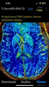 MedVizi™ CT-MRI Viewer screenshot 1