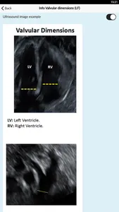 Fetal BCN Calculator screenshot 1