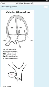 Fetal BCN Calculator screenshot 2