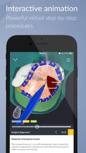 UpSurgeOn Neurosurgery screenshot 3