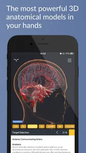 UpSurgeOn Neurosurgery screenshot 4