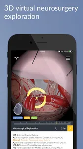 UpSurgeOn Neurosurgery screenshot 5