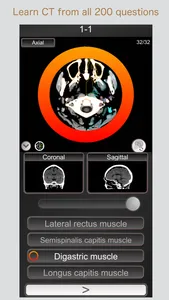 CT PassQuiz Head/Brain / MRI screenshot 0