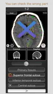 CT PassQuiz Head/Brain / MRI screenshot 1