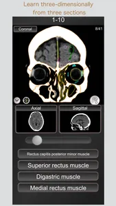 CT PassQuiz Head/Brain / MRI screenshot 2