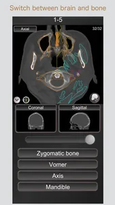 CT PassQuiz Head/Brain / MRI screenshot 3