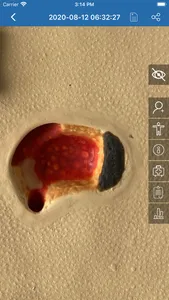 WoundDoc3 screenshot 1