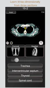 CT PassQuiz Chest / MRI screenshot 2