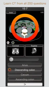 CT PassQuiz Abdomen / MRI screenshot 0