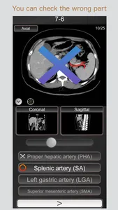 CT PassQuiz Abdomen / MRI screenshot 1