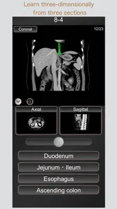 CT PassQuiz Abdomen / MRI screenshot 2