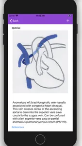 Vascular Variants screenshot 3