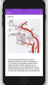 Vascular Variants screenshot 4