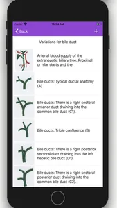 Vascular Variants screenshot 5