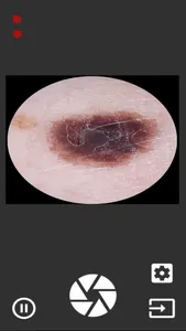 DermaForge VLStream screenshot 0