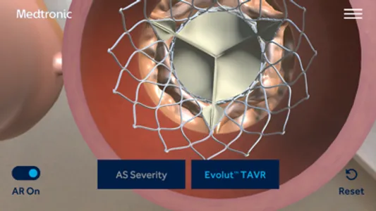 AS TAVR Education screenshot 4