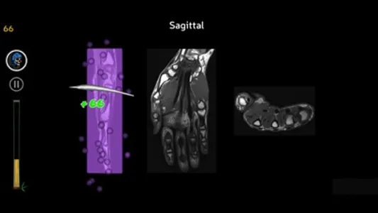 Anatomy Ninja Upper Limb screenshot 2