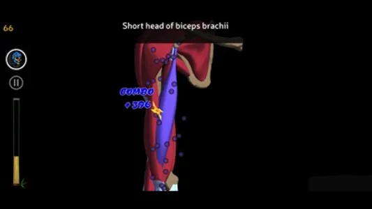 Anatomy Ninja Upper Limb screenshot 4