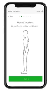 Mölnlycke Wound Support screenshot 0