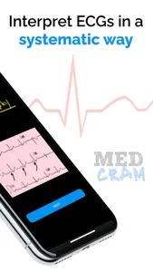 ECG / EKG Explained Clearly screenshot 1