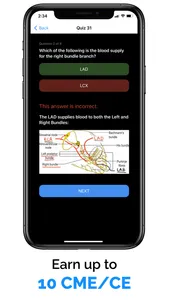 ECG / EKG Explained Clearly screenshot 4