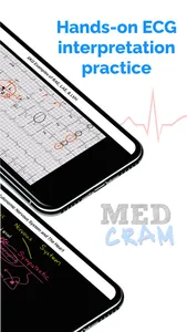 ECG / EKG Explained Clearly screenshot 6