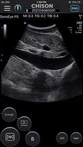 SonoEye screenshot 1