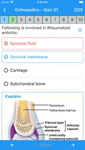 Physiotherapy Quiz screenshot 9