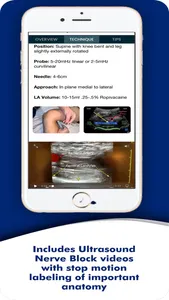 PNBschool Anesthesia Blocks screenshot 1