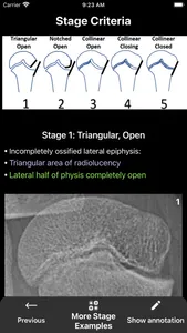 What's the Skeletal Maturity? screenshot 6