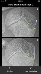 What's the Skeletal Maturity? screenshot 7