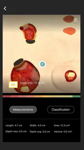 NATROX® IQ Advanced Wound Hub screenshot 2