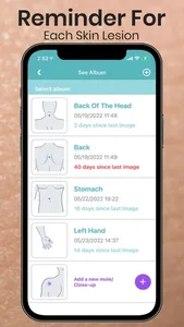 Mole Checker Skin Dermatology screenshot 7