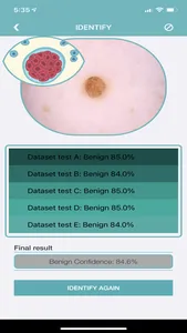 Mole Checker Skin Dermatology screenshot 8