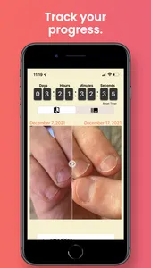 NailKeeper - Stop Biting Nails screenshot 0
