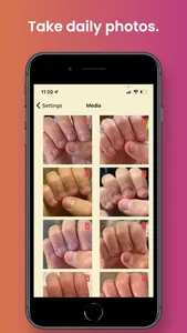 NailKeeper - Stop Biting Nails screenshot 2