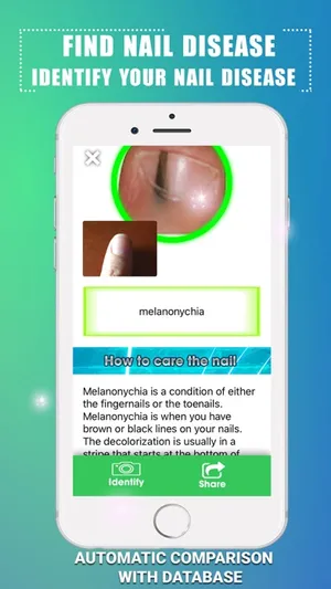 Find Nail Disease screenshot 2