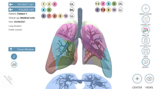 LUNG-NOTE screenshot 2