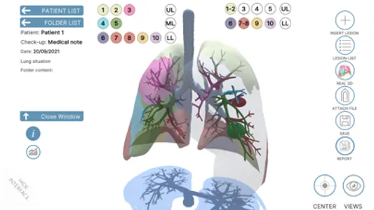 LUNG-NOTE screenshot 3