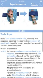 Nerve Conduction Studies screenshot 2