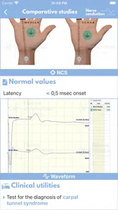 Nerve Conduction Studies screenshot 3