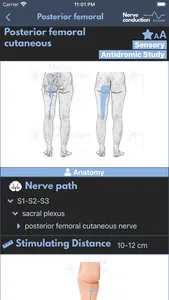 Nerve Conduction Studies screenshot 4