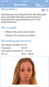 Nerve Conduction Studies screenshot 6