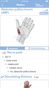 Nerve Conduction Studies screenshot 7