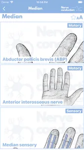 Nerve Conduction Studies screenshot 8