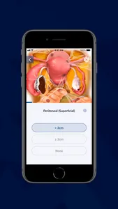 AAGL Endo Classification screenshot 1