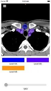 Neck lymph node map screenshot 1