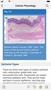 ASCRS-U: Colorectal Surgery screenshot 2