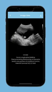 Ultrasound Protocol HandBook screenshot 4